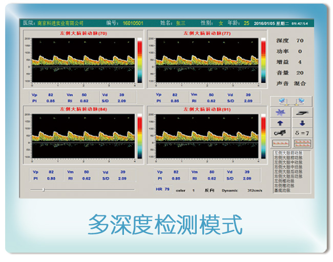 卖家 仪器仪表 分析仪>2016年m普通版经颅多普勒tcd脑彩超品牌生产